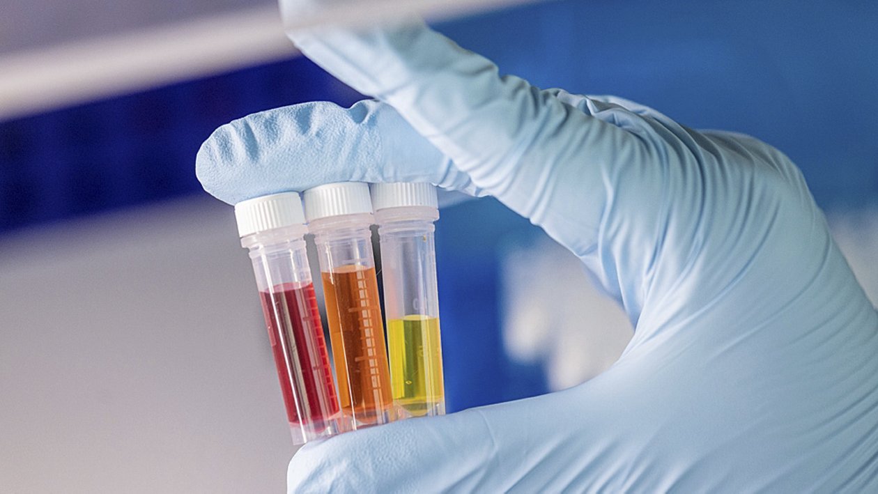 Modern diagnostics and sample collection