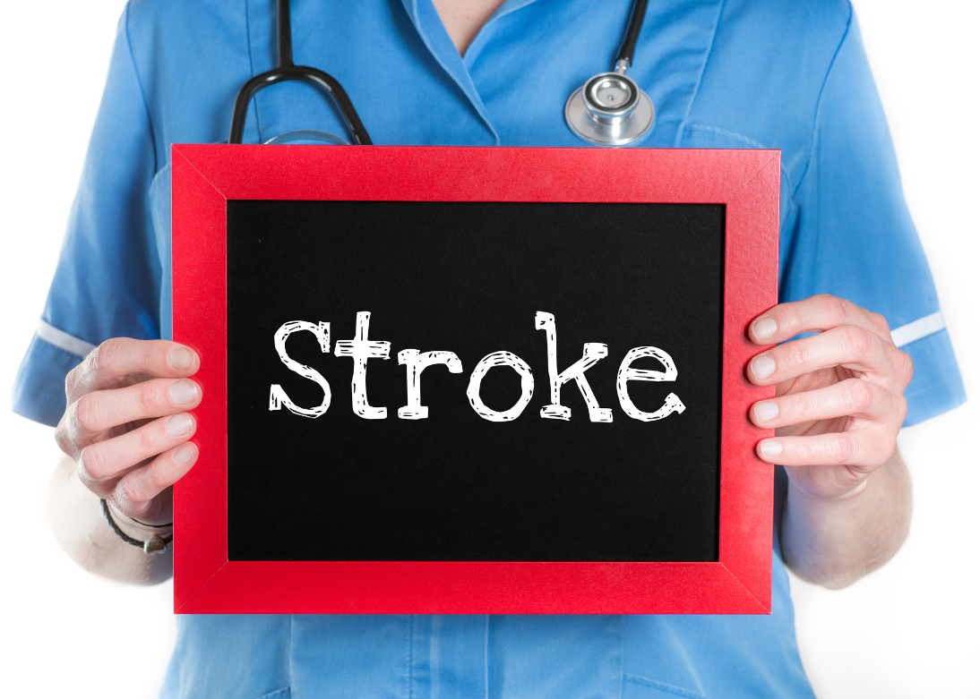 Stroke Rehabilitation